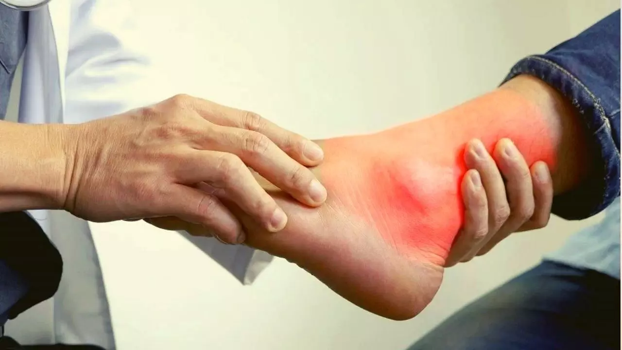 യൂറിക് ആസിഡ് കൂടിയാല്‍ ശരീരത്തിലുണ്ടാകുന്ന ലക്ഷണങ്ങള്‍