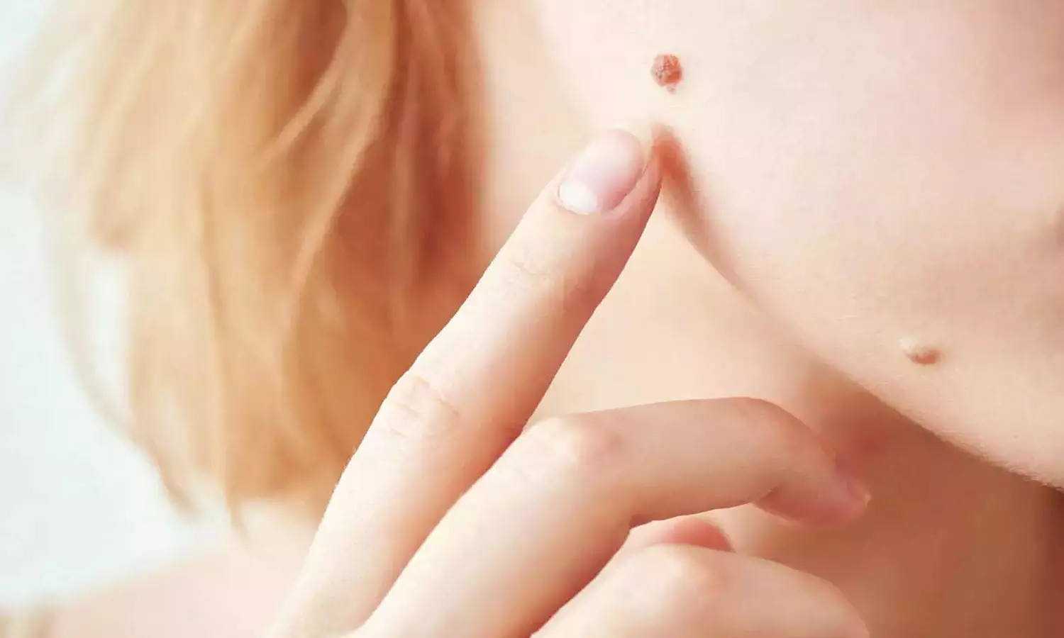 എന്തു ചെയ്തിട്ടും പാലുണ്ണി പോകുന്നില്ലേ?