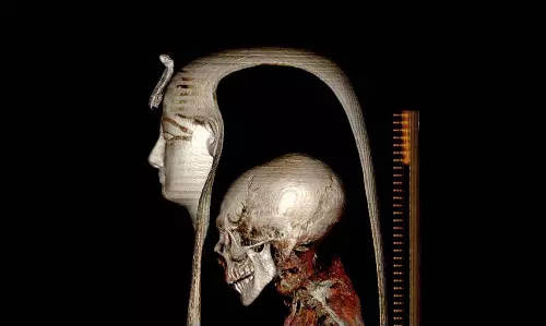 3,500 വര്‍ഷം പഴക്കമുള്ള മമ്മിക്കുള്ളിലെ രഹസ്യങ്ങള്‍ അതിനൂതന സ്‌കാനിങ് സംവിധാനത്തിലൂടെ പുറത്തെത്തിച്ച് ഈജിപ്ഷ്യന്‍ ശാസ്ത്രജ്ഞര്‍