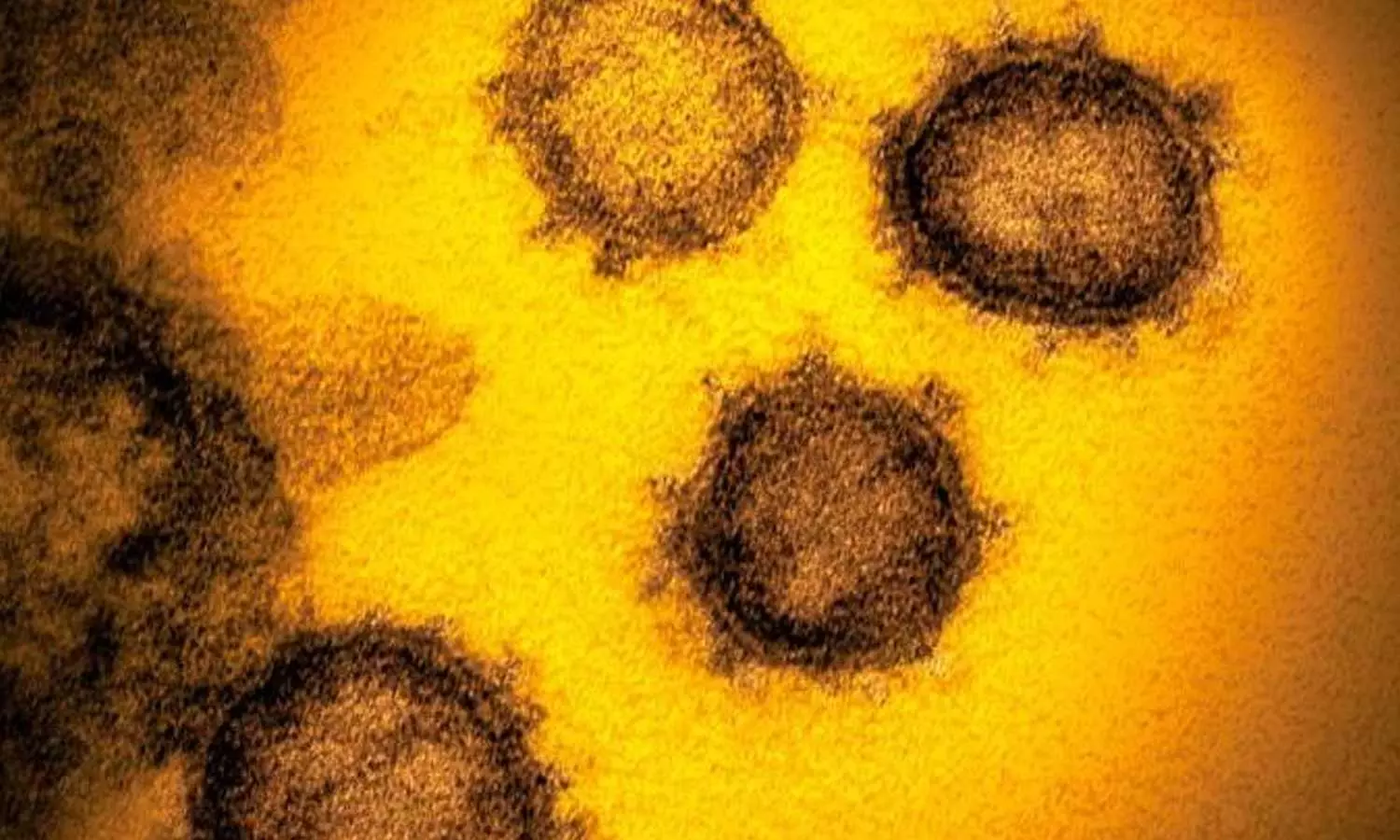 ഒമിക്രോൺ:  കേരളമടക്കം എട്ടു സംസ്ഥാനങ്ങൾ കർശന ശ്രദ്ധ പുലർത്തണമെന്ന് കേന്ദ്രം