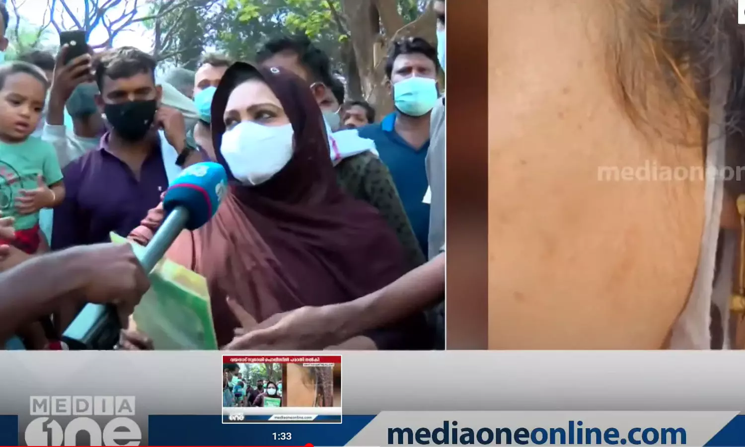 കോഴിക്കോട് മെഡിക്കൽ കോളജിലെ സെക്യൂരിറ്റി ജീവനക്കാരൻ യുവതിയുടെ മുഖത്തടിച്ചെന്ന് പരാതി കോഴിക്കോട് മെഡിക്കൽ കോളജിലെ സെക്യൂരിറ്റി ജീവനക്കാരൻ യുവതിയുടെ മുഖത്തടിച്ചെന്ന് പരാതി