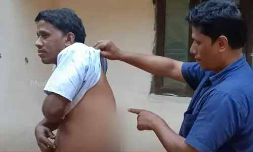 ഉണക്കാനിട്ട കാപ്പിക്കുരു പശുതിന്നു; ക്ഷീരകർഷകന് ഇരുമ്പുവടികൊണ്ട് ക്രൂരമർദനം