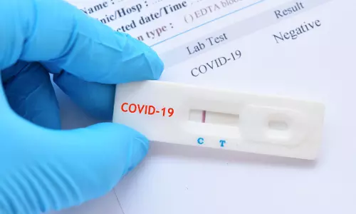 കോവിഡ് റാപിഡ് ടെസ്റ്റ് ഫലം വെബ്സൈറ്റിൽ നൽകുന്ന രീതിയില്ലെന്ന് കോവിഡ് റാപിഡ് ടെസ്റ്റ് ഫലം വെബ്സൈറ്റിൽ നൽകുന്ന രീതിയില്ലെന്ന്