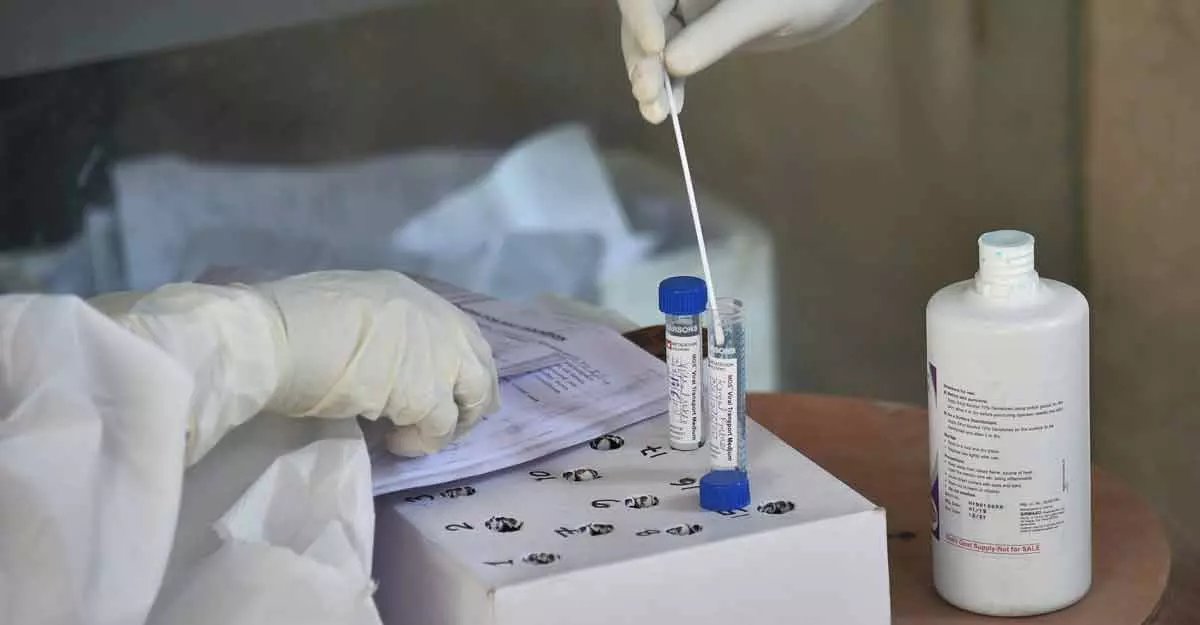 കോവിഡ് ടെസ്റ്റിന് നിരക്ക് കുറച്ച സർക്കാർ നടപടി; പ്രതിഷേധവുമായി ലബോറട്ടറി ഓണേഴ്സ് അസോസിയേഷൻ കോവിഡ് ടെസ്റ്റിന് നിരക്ക് കുറച്ച സർക്കാർ നടപടി; പ്രതിഷേധവുമായി ലബോറട്ടറി ഓണേഴ്സ് അസോസിയേഷൻ