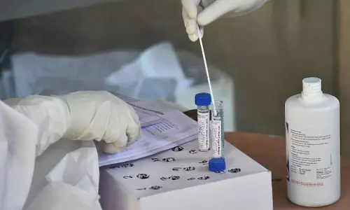 കോവിഡ് ടെസ്റ്റിന് നിരക്ക് കുറച്ച സർക്കാർ നടപടി; പ്രതിഷേധവുമായി ലബോറട്ടറി ഓണേഴ്സ് അസോസിയേഷൻ കോവിഡ് ടെസ്റ്റിന് നിരക്ക് കുറച്ച സർക്കാർ നടപടി; പ്രതിഷേധവുമായി ലബോറട്ടറി ഓണേഴ്സ് അസോസിയേഷൻ