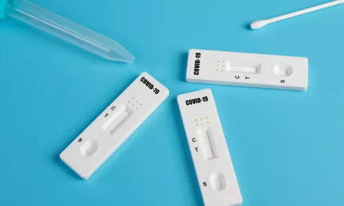 കർണാടകയിലെ ആശുപത്രിയിലെത്തുന്ന രോഗികൾക്ക് ലക്ഷണമില്ലെങ്കിൽ ഇനി കോവിഡ് പരിശോധന വേണ്ട കർണാടകയിലെ ആശുപത്രിയിലെത്തുന്ന രോഗികൾക്ക് ലക്ഷണമില്ലെങ്കിൽ ഇനി കോവിഡ് പരിശോധന വേണ്ട