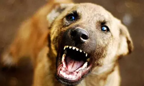 കോഴിക്കോട് തെരുവ് നായ ആക്രമണം; 36 പേർക്ക് പരിക്ക്