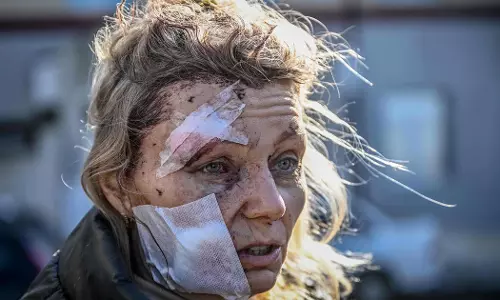 ഈ യുദ്ധം അവസാനിപ്പിക്കൂ: ലോകമനസാക്ഷിയെ ഉലച്ച ആ മുഖം ഇതാ ഇവിടെയുണ്ട് ഈ യുദ്ധം അവസാനിപ്പിക്കൂ: ലോകമനസാക്ഷിയെ ഉലച്ച ആ മുഖം ഇതാ ഇവിടെയുണ്ട്