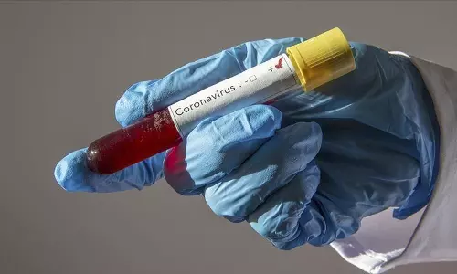 സൗദിയിലെ ആശുപത്രികളില്‍ ഇനി കോവിഡ് പരിശോധന ആവശ്യമില്ല