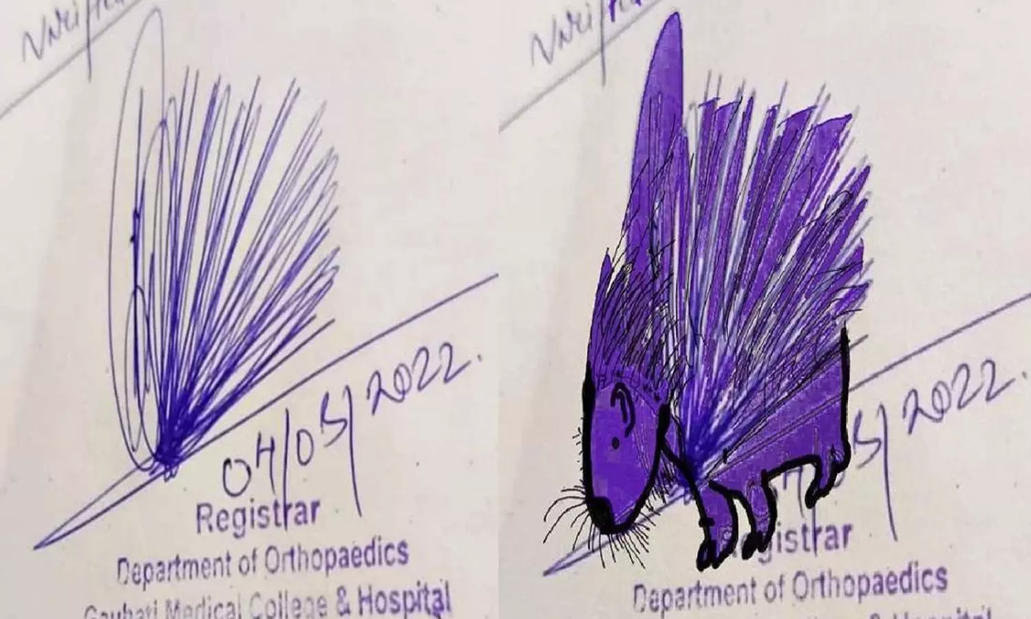 മുള്ളൻ പന്നിയുടെ ചിത്രമല്ല; ഇതാണ് വൈറൽ ഒപ്പ് മുള്ളൻ പന്നിയുടെ ചിത്രമല്ല; ഇതാണ് വൈറൽ ഒപ്പ്
