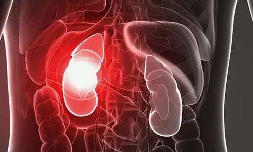കിഡ്നി രോഗം നിസാരമല്ല; ഈ ലക്ഷണങ്ങൾ ശ്രദ്ധിക്കണം