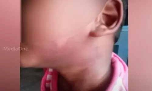 പിഞ്ചുകുഞ്ഞുങ്ങളെ സ്കെയിലുകൊണ്ട് ക്രൂരമായി മര്‍ദിച്ചു; പാലക്കാട് ശിശുക്ഷേമ സമിതി സെക്രട്ടറിക്കെതിരെ അന്വേഷണം