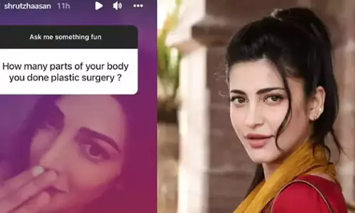 പ്ലാസ്റ്റിക് സര്‍ജറിയെ കുറിച്ച് ആരാധകന്‍റെ ചോദ്യം; മറുപടിയുമായി ശ്രുതി ഹാസന്‍