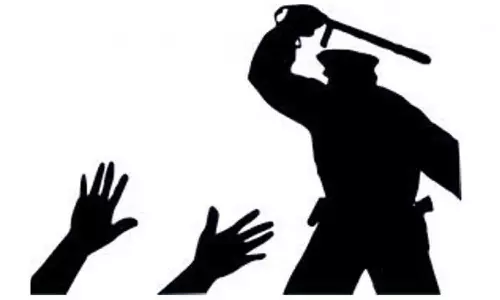 ദലിതനായ മധ്യവയസ്കനെ പൊലീസ് മർദിച്ചതായി പരാതി ദലിതനായ മധ്യവയസ്കനെ പൊലീസ് മർദിച്ചതായി പരാതി