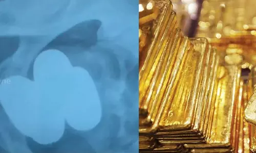 കരിപ്പൂരിൽ രണ്ട് കിലോയോളം സ്വർണം പിടികൂടി: കടത്തിയത് സ്വർണ ഉരുളകളായി ശരീരത്തിൽ ഒളിപ്പിച്ച്‌