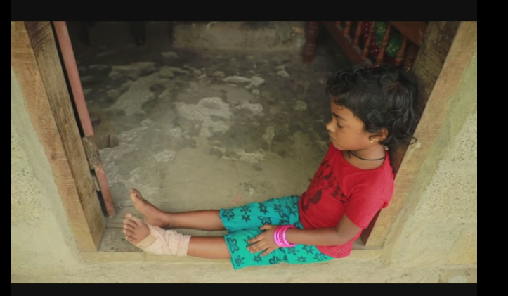 ബുക്കിന്‍റെ പേപ്പർ കീറിയതിന് നാലു വയസുകാരിക്ക് അംഗനവാടി ജീവനക്കാരിയുടെ മര്‍ദനം