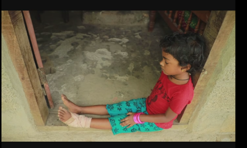 ബുക്കിന്‍റെ പേപ്പർ കീറിയതിന് നാലു വയസുകാരിക്ക് അംഗനവാടി ജീവനക്കാരിയുടെ മര്‍ദനം