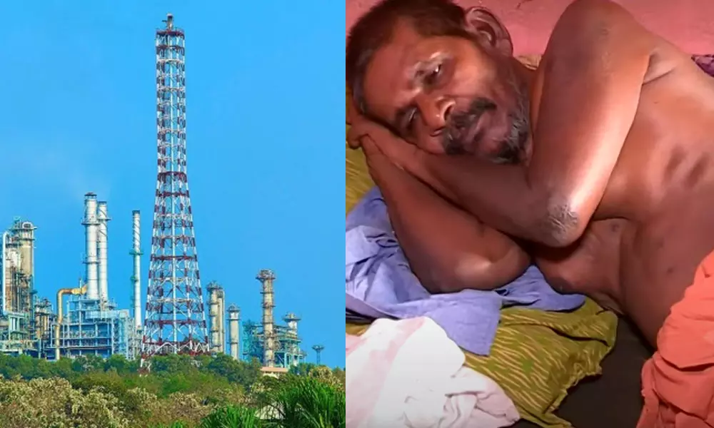 ബി.പി.സി.എല് പുറന്തള്ളുന്ന രാസവാതകം ശ്വസിച്ച് മാറാരോഗികളായി അമ്പലമുകള് വാസികള് ബി.പി.സി.എല് പുറന്തള്ളുന്ന രാസവാതകം ശ്വസിച്ച് മാറാരോഗികളായി അമ്പലമുകള് വാസികള്