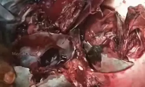 പൂന്തുറയിൽ ലേലത്തിൽ പിടിച്ചെടുത്ത മീനിൽ പുഴു; പരിശോധന കർശനമക്കി ഭക്ഷ്യസുരക്ഷാ വിഭാഗം