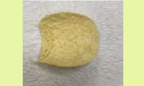 1.63 ലക്ഷം രൂപയ്ക്ക് ഒരു പൊട്ടറ്റോ ചിപ്സ്; വിലകേട്ട് ഞെട്ടിയോ..എങ്കില് കാരണം കൂടി കേള്ക്കൂ... 1.63 ലക്ഷം രൂപയ്ക്ക് ഒരു പൊട്ടറ്റോ ചിപ്സ്; വിലകേട്ട് ഞെട്ടിയോ..എങ്കില് കാരണം കൂടി കേള്ക്കൂ...