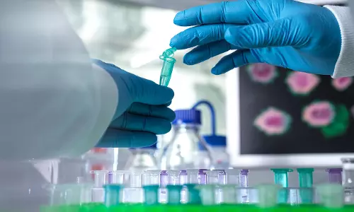 കുരങ്ങുപനി പടരുന്നു;  യു.എ.ഇയിലും കനത്ത ജാഗ്രത