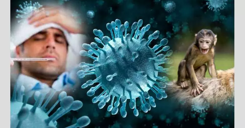 കുരങ്ങു പനി: കുവൈത്ത് ആരോഗ്യമന്ത്രാലയം മാർഗനിർദേശങ്ങൾ പുറപ്പെടുവിച്ചു