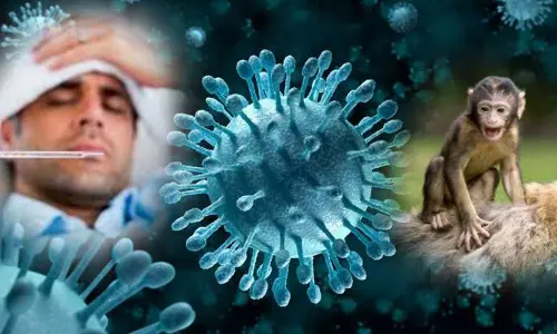 കുരങ്ങു പനി: കുവൈത്ത് ആരോഗ്യമന്ത്രാലയം മാർഗനിർദേശങ്ങൾ പുറപ്പെടുവിച്ചു