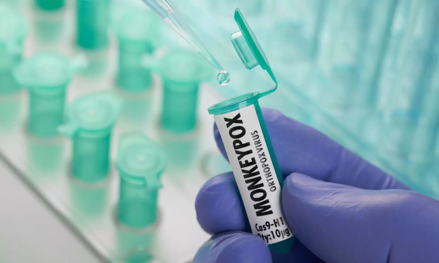 അയർലാന്റിൽ ആദ്യമായി കുരങ്ങുപനി സ്ഥിരീകരിച്ചു അയർലാന്റിൽ ആദ്യമായി കുരങ്ങുപനി സ്ഥിരീകരിച്ചു