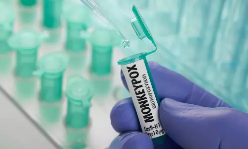 അയർലാന്റിൽ ആദ്യമായി കുരങ്ങുപനി സ്ഥിരീകരിച്ചു