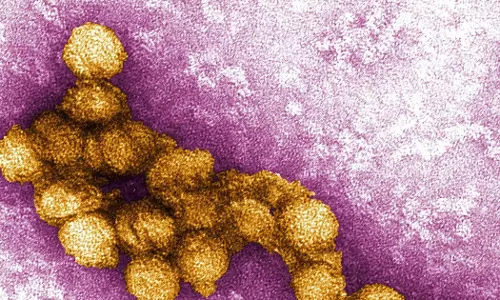 തൃശൂരിൽ ഒരാൾക്ക് വെസ്റ്റ് നൈൽ ഫീവർ; പ്രദേശത്ത് ക്യൂലക്‌സ് കൊതുകുകളുടെ സാന്നിധ്യം