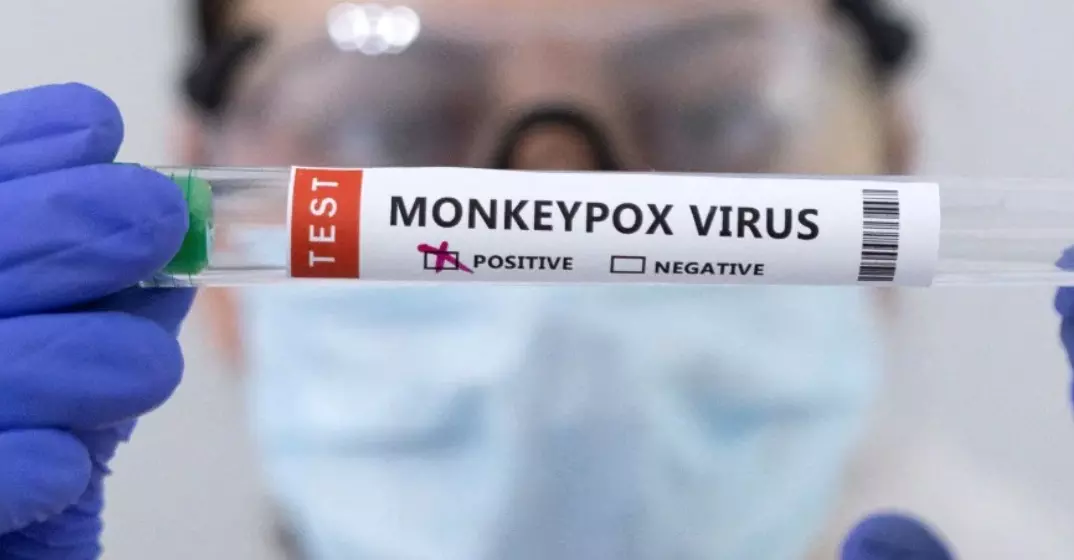 മൂന്ന് പേര്‍ക്ക് കൂടി കുരങ്ങുപനി; ജാഗ്രത ശക്തമാക്കി യു.എ.ഇ