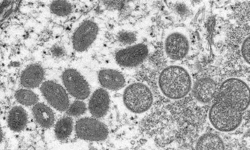 കുരങ്ങുപനിക്കെതിരെ യു.എ.ഇയിൽ ജാഗ്രത; സുരക്ഷാ-പ്രതിരോധ മാനദണ്ഡങ്ങൾ പ്രഖ്യാപിച്ചു