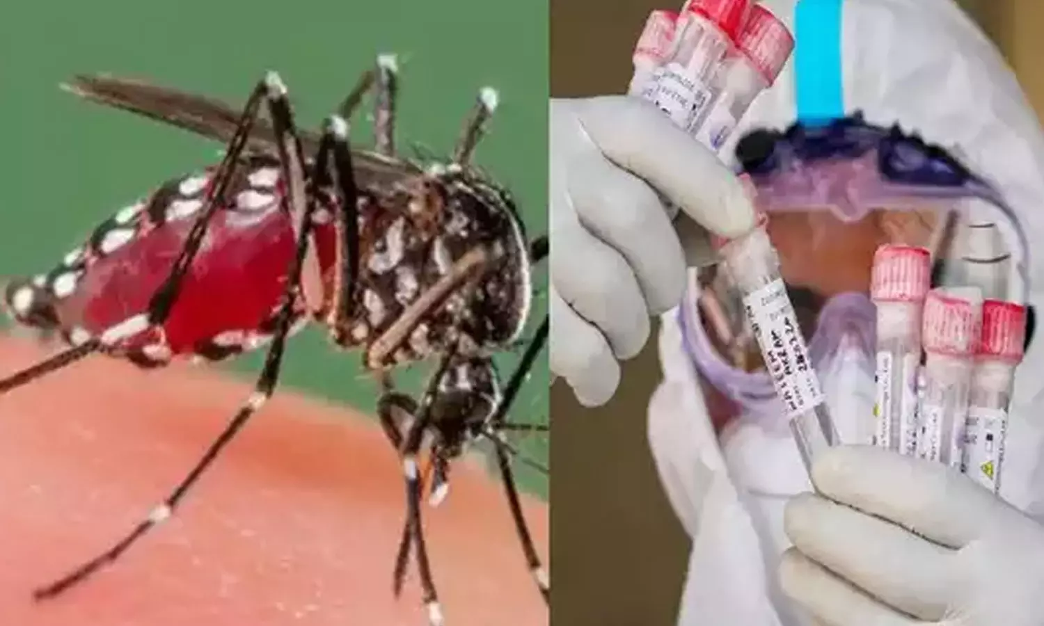 West Nile fever: one death in Kozhikode,latest news malayalamവെസ്റ്റ്നൈൽ പനി: കോഴിക്കോട്ട് ഒരു മരണം