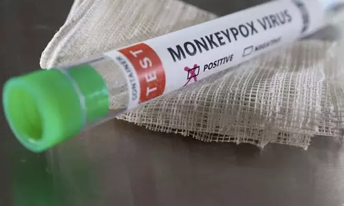 ആഗോളതലത്തിൽ 700-ലധികം കുരങ്ങുപനി കേസുകൾ റിപ്പോർട്ട് ചെയ്തായി യു.എസ്