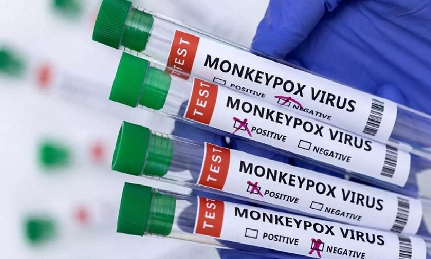 കുരങ്ങുപനി: ആരോഗ്യ അടിയന്തരാവസ്ഥ പ്രഖ്യാപിക്കുമോ..? ലോകാരോഗ്യ സംഘടന വ്യക്തമാക്കുന്നു കുരങ്ങുപനി: ആരോഗ്യ അടിയന്തരാവസ്ഥ പ്രഖ്യാപിക്കുമോ..? ലോകാരോഗ്യ സംഘടന വ്യക്തമാക്കുന്നു