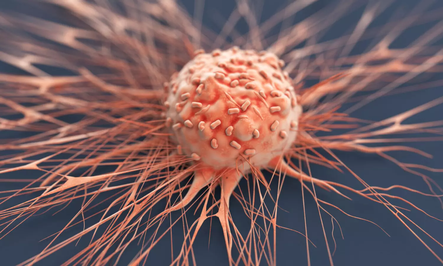 ഈ ലക്ഷണങ്ങൾ ശ്രദ്ധിക്കണം; തൊണ്ടയിലെ കാൻസറാകാം