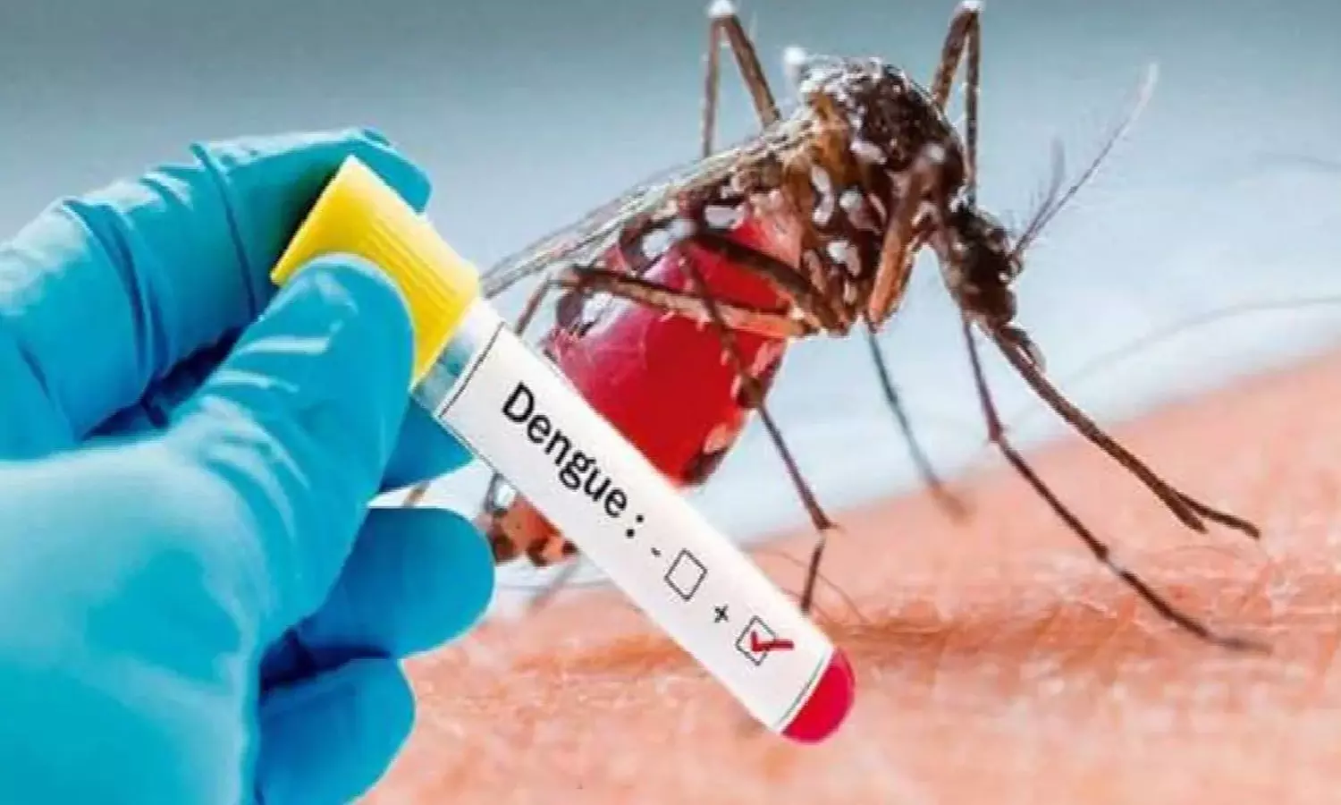 തുടരുന്ന മഴ, പടരുന്ന പനി; ഡെങ്കിപ്പനിയെ സൂക്ഷിക്കാം തുടരുന്ന മഴ, പടരുന്ന പനി; ഡെങ്കിപ്പനിയെ സൂക്ഷിക്കാം