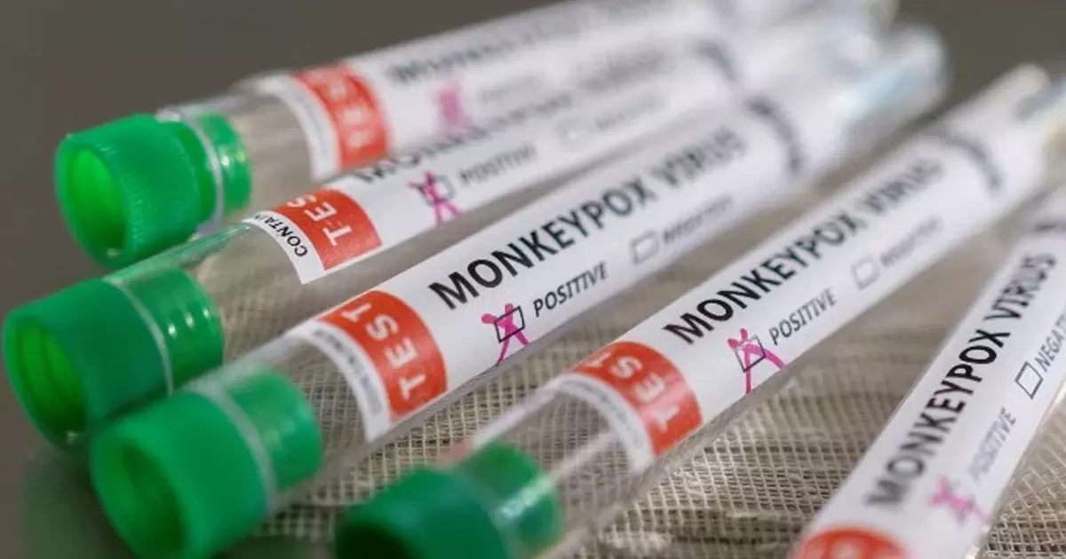 കുരങ്ങ് വസൂരി: അഞ്ച് ജില്ലകള്‍ക്ക് പ്രത്യേക ജാഗ്രതാനിര്‍ദേശം, പുതിയ മാര്‍ഗരേഖ