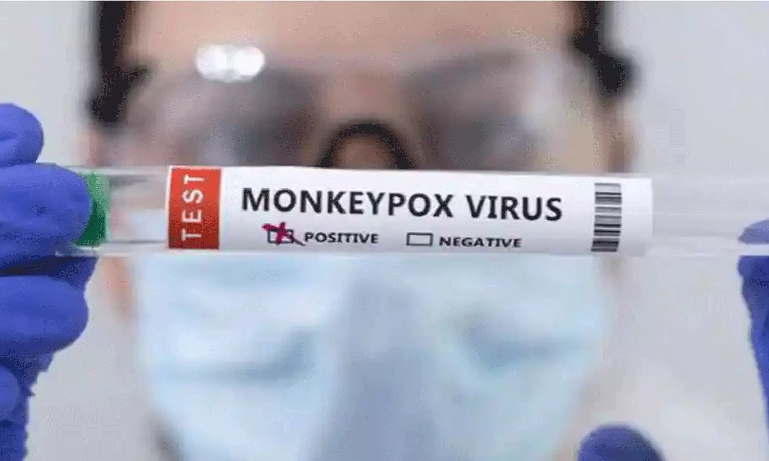 കുരങ്ങ് വസൂരി: സാമ്പിൾ പരിശോധനക്ക് രാജ്യത്തുടനീളം 15 ലാബുകൾ സജ്ജം; കേന്ദ്രം