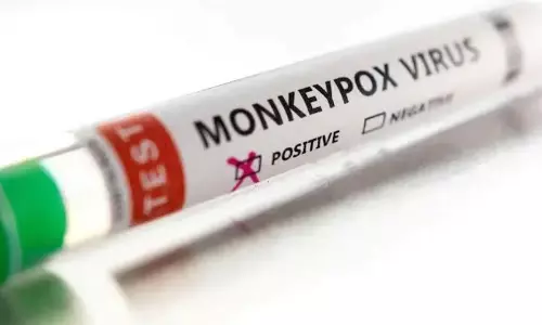 കുരങ്ങുവസൂരി: രോഗിയെ എത്തിച്ച കാറിന്‍റെ ഡ്രൈവറെ തിരിച്ചറിഞ്ഞു