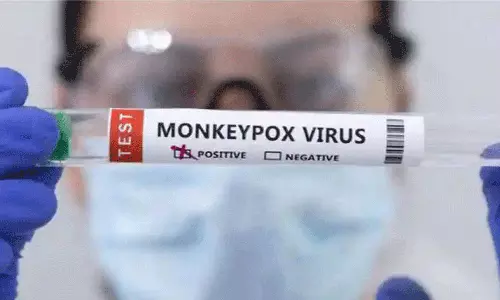 കുരങ്ങുവസൂരി സ്ഥിരീകരിച്ച കണ്ണൂരിലെ യുവാവിന്റെ ചികിത്സക്കായി പ്രത്യേക സംഘത്തെ നിയോഗിച്ചു