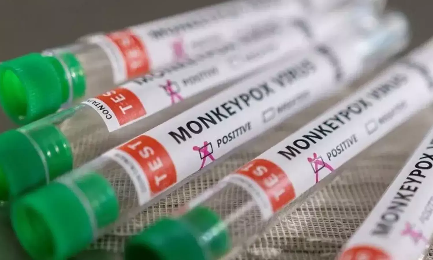 സംസ്ഥാനത്ത് ഒരാൾക്കുകൂടി കുരങ്ങുവസൂരി; സ്ഥിരീകരിച്ചത് കണ്ണൂര്‍ സ്വദേശിക്ക്