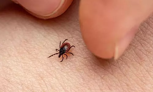 തിരുവനന്തപുരത്ത് ചെള്ളുപനി ബാധിച്ച് വിദ്യാർഥി മരിച്ചു