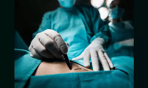 നൂതന ശസ്ത്രക്രിയാ രീതിയിലൂടെ ലോകത്തിലാദ്യമായി ഉമിനീർഗ്രന്ഥിയിലെ കല്ലുകൾ നീക്കം ചെയ്ത് കുവൈത്തി ഡോക്ടർ നൂതന ശസ്ത്രക്രിയാ രീതിയിലൂടെ ലോകത്തിലാദ്യമായി ഉമിനീർഗ്രന്ഥിയിലെ കല്ലുകൾ നീക്കം ചെയ്ത് കുവൈത്തി ഡോക്ടർ