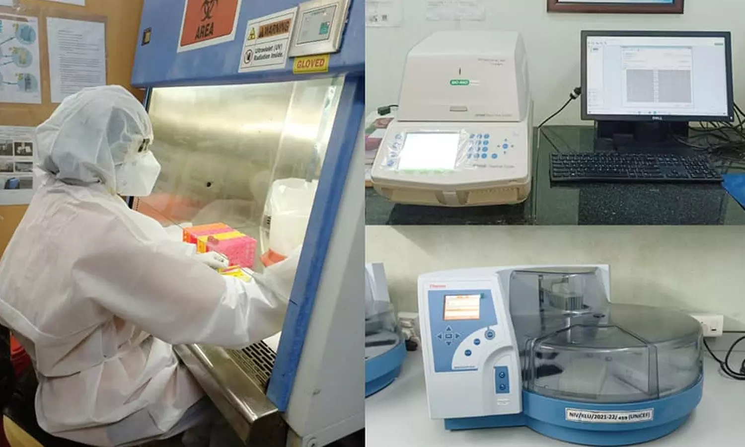 കുരങ്ങു വസൂരി ലക്ഷണം; കണ്ണൂരിൽ ഏഴുവയസ്സുകാരി ചികിത്സയിൽ