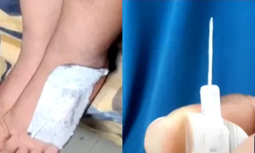 നെയ്യാറ്റിൻകരയില്‍ ഡ്രിപ്പിടാനെത്തിയ കുഞ്ഞിന്റെ കാലിൽ സൂചി ഒടിഞ്ഞ് കയറി