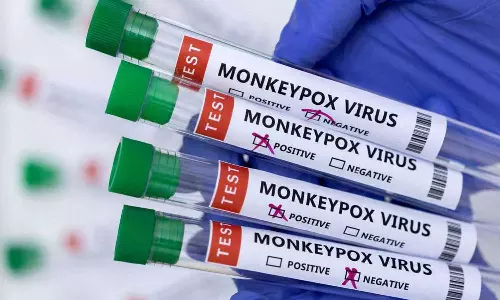 മങ്കിപോക്സ്‌ ഇനി വേഗത്തിൽ കണ്ടെത്താം; ആർടിപിസിആർ കിറ്റ് പുറത്തിറക്കി