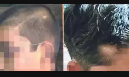 ക്ലാസിൽ ചൂളമടിച്ചെന്ന് ആരോപിച്ച് പ്രധാനാധ്യാപിക വിദ്യാർഥികളുടെ മുടി മുറിച്ചെന്ന് പരാതി ക്ലാസിൽ ചൂളമടിച്ചെന്ന് ആരോപിച്ച് പ്രധാനാധ്യാപിക വിദ്യാർഥികളുടെ മുടി മുറിച്ചെന്ന് പരാതി