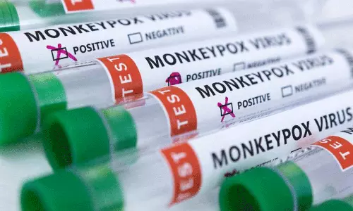 സംസ്ഥാനത്ത് ഒരാൾക്ക് കൂടി കുരങ്ങുവസൂരി സ്ഥിരീകരിച്ചു