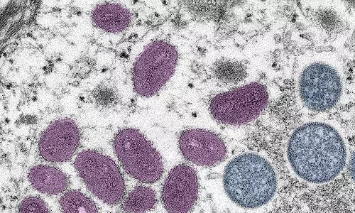 കുരങ്ങ് വസൂരി വ്യാപനം തടയാൻ മാർഗനിർദേശം പുറത്തിറക്കി കേന്ദ്ര ആരോഗ്യമന്ത്രാലയം